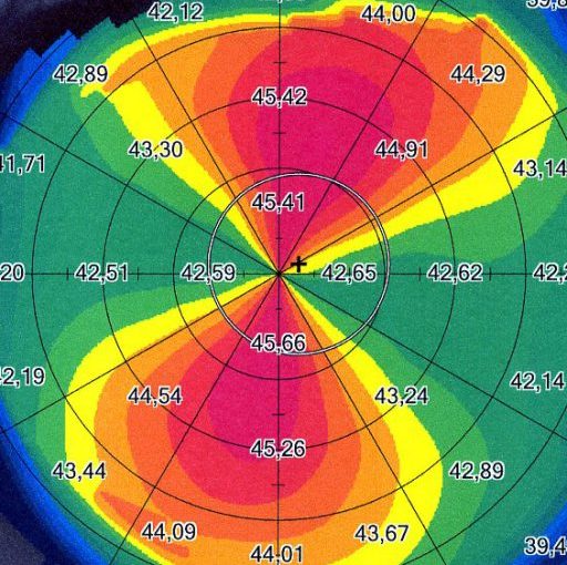Y LA IDEA SE LLEVÓ A LA&nbsp;PRÁCTICA