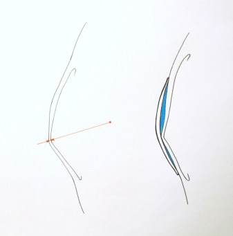 TEMA 2 - PERFIL DE QUERATOCONO SIN Y CON LC RPG CORNEAL