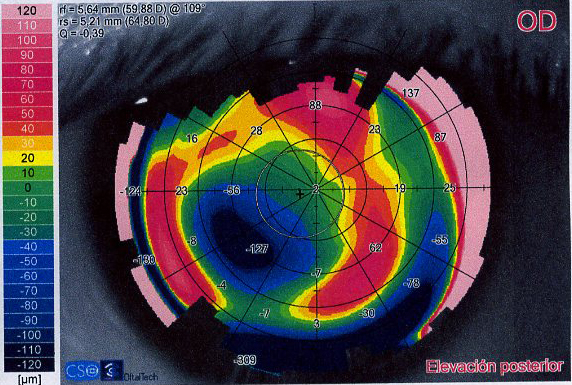 TEMA 5 - MAPA DE ELEVACIÓN